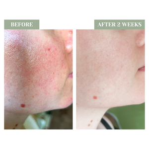 B12 CALM SERUM