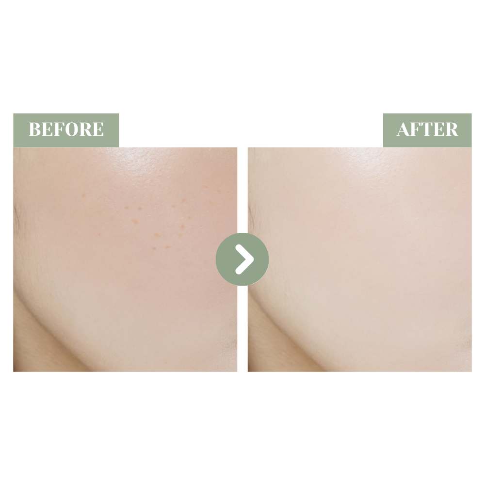 SHEGAIA Blanc Procedure Radiance Serum 極萃光感淡斑精華| Ambrosia