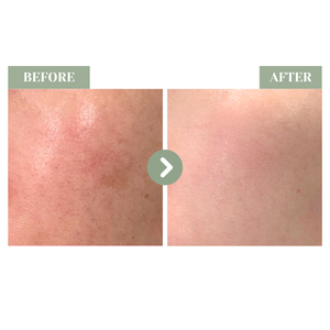 SHEGAIA Mitobliss Brightening Mask 極致煥白水光透亮安瓶面膜 | Ambrosia | 香港