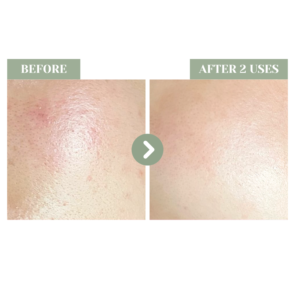 SHEGAIA VasoChill™ Cream 藍烴急救舒緩修護水凝霜| Ambrosia | 香港