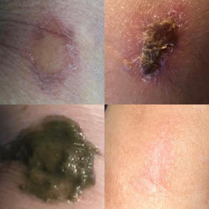 Marie Reynolds London Restore Before & After | Ambrosia | Hong Kong