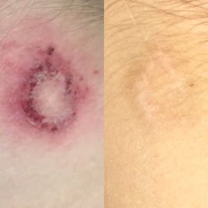 Marie Reynolds London Restore Before & After | Ambrosia | Hong Kong